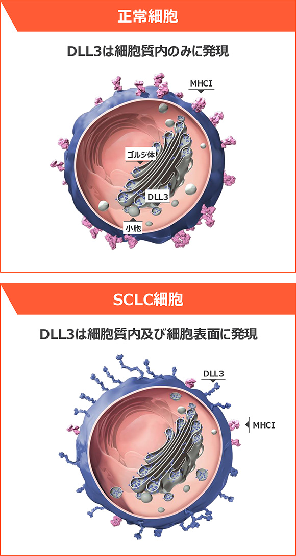 図6 正常細胞とSCLC細胞のDLL3発現